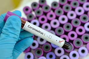 Coronavirus Advice For Small Businesses